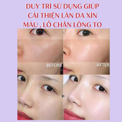 Xà Phòng Rửa Mặt ,Làm Sạch Bã Nhờn Và Mụn Vùng Cánh Mũi Pelican Dot Washy (75G)