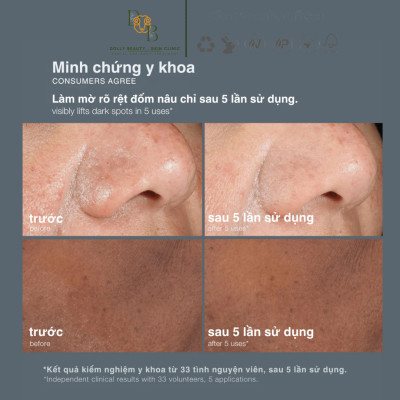 POWERBRIGHT DARK SPOT PEEL cải thiện sắc tố, giúp sáng, mịn, đều màu da của Dermalogica