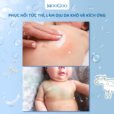 Kem dưỡng ẩm phục hồi khẩn cấp thẩm thấu nhanh chứa Ceramides cho da nhạy cảm, rôm sảy, chàm sữa, viêm cơ địa - Moogoo