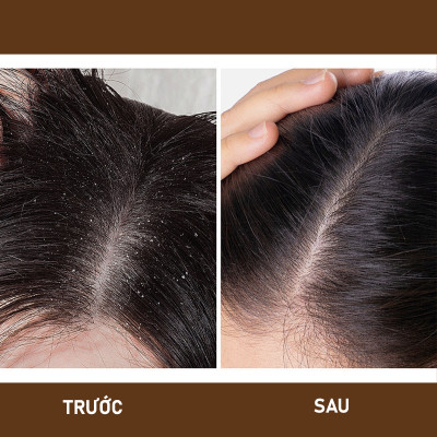 [Thảo Dược Thật] Dầu gội bồ kết, dầu gội thảo dược phụ hồi tóc, ngăn ngừa gãy rụng - Ngưu Cân Thảo Chai 1000ml