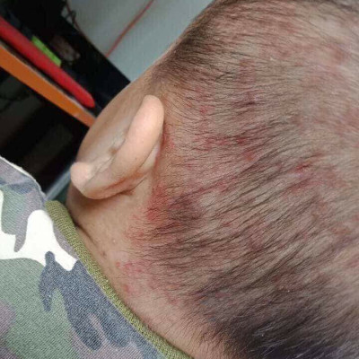 SỮA TẮM LÁ KHỔ QUA RỪNG MẸ KEN-CHAI 100ML