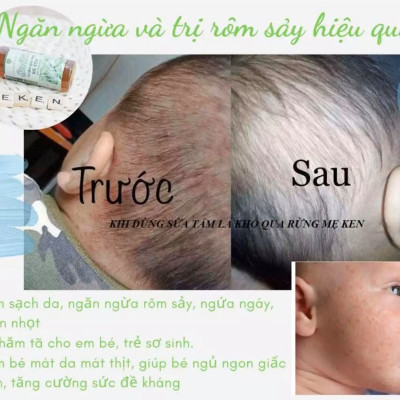 SỮA TẮM LÁ KHỔ QUA RỪNG MẸ KEN -100ML ( Hỗ trợ trị rôm sẩy cho bé ,hăm tả, ngứa da)