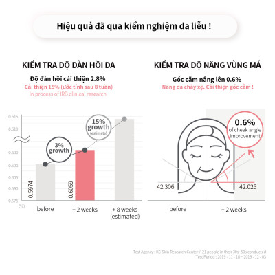 Young &be Kem Tái Tạo Và Làm Trắng Da Hiệu Quả