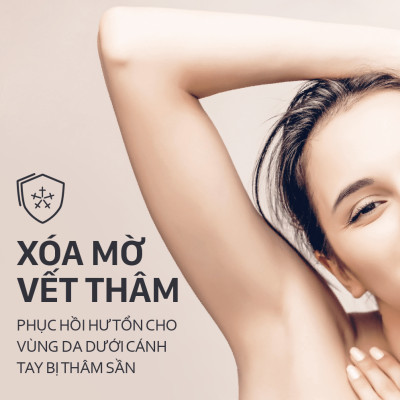 Lăn Khử Mùi – Trắng Mịn – Ngọt Ngào M.pros 60ml