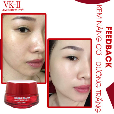Kem Nâng Cơ Lão Hóa Trắng Da VK II 35g