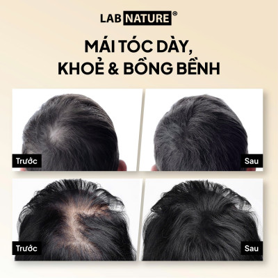 [MỚI] Xịt Ngăn Rụng Tóc, Làm Dày Tóc Lab Nature Hair - Loss Spray 100ml - Dành cho tóc thưa, mảnh
