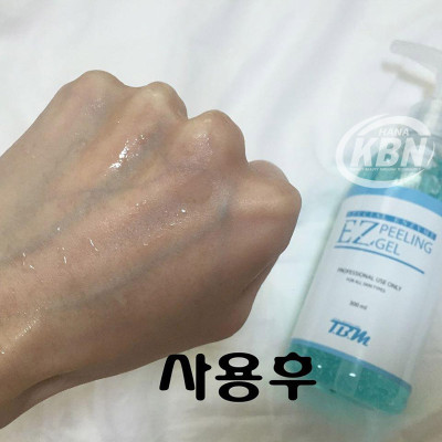 Gel Tẩy Tế Bào Chết Ez Peeling TBM (300ml)  (Hàng Chính Hãng)