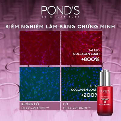 Serum Ngăn Ngừa Lão Hóa Pond