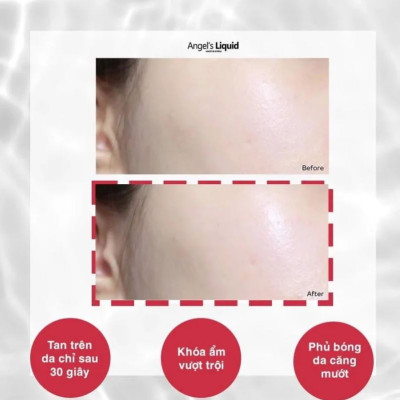 Kem Dưỡng Hỗ Trợ Giảm Thâm Nám Angel