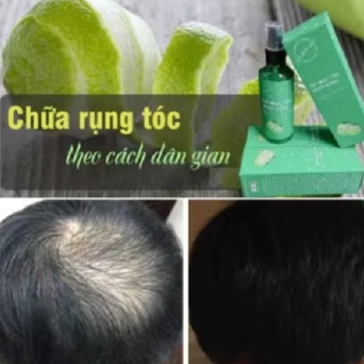tinh dầu bưởi xịt kích thích mọc tóc loại tốt 