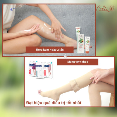 Combo 2 tuýp kem thoa suy giãn tĩnh mạch chân