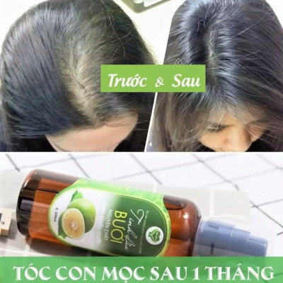 Combo Dầu Gội MẸ KEN 500ml & Tinh Dầu Bưởi MẸ KEN 100ml - kích thích mọc tóc, ngăn ngừa gãy rụng