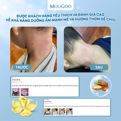 Sáp chống rạn cho mẹ bầu bơ hạt mỡ dưỡng da siêu khô, nứt nẻ gót chân, da vảy nến MooGoo